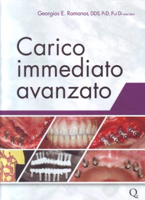 Carico immediato avanzato